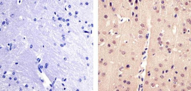 PAX3 Antibody in Immunohistochemistry (Paraffin) (IHC (P))