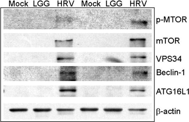 VPS34 Antibody in Western Blot (WB)