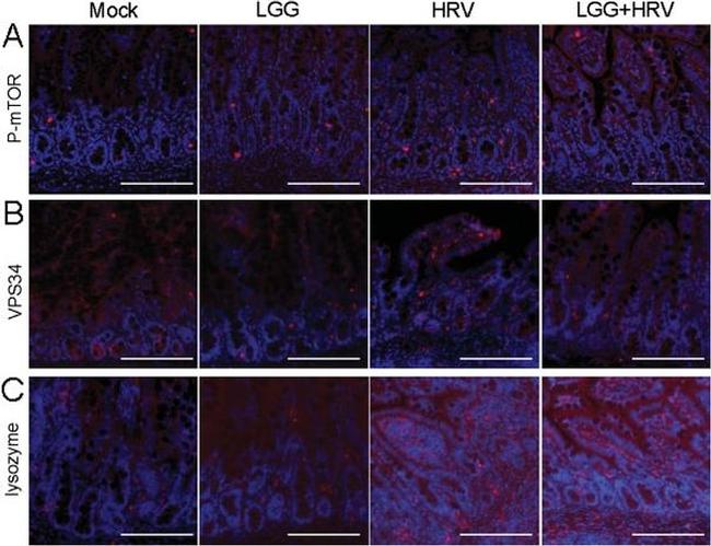 VPS34 Antibody in Immunohistochemistry (IHC)