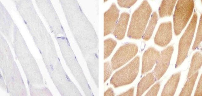 VPS34 Antibody in Immunohistochemistry (Paraffin) (IHC (P))