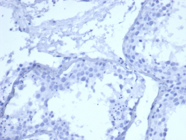 Cytokeratin 5 (KRT5) Antibody in Immunohistochemistry (Paraffin) (IHC (P))