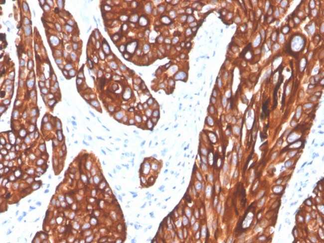 Cytokeratin 5 (KRT5) Antibody in Immunohistochemistry (Paraffin) (IHC (P))