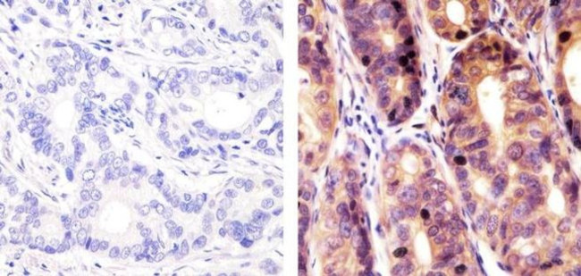 SOCS1 Antibody in Immunohistochemistry (Paraffin) (IHC (P))