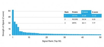 Cytokeratin 6A (KRT6A) (Basal Cell Marker) Antibody in Peptide array (ARRAY)