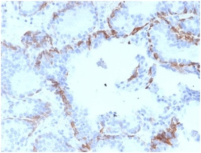 Cytokeratin 6A (KRT6A) (Basal Cell Marker) Antibody in Immunohistochemistry (Paraffin) (IHC (P))