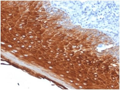 Cytokeratin 6A (KRT6A) (Basal Cell Marker) Antibody in Immunohistochemistry (Paraffin) (IHC (P))