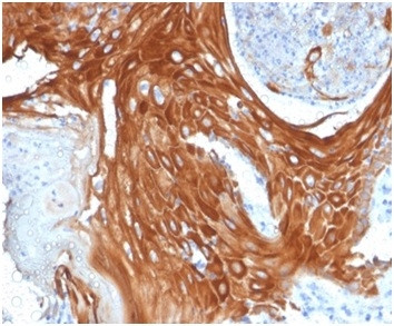 Cytokeratin 6A (KRT6A) (Basal Cell Marker) Antibody in Immunohistochemistry (Paraffin) (IHC (P))