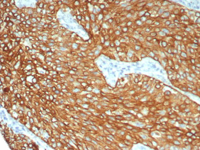 Cytokeratin 6/KRT6 (Pan; a,b,c) (Basal Cell Marker) Antibody in Immunohistochemistry (Paraffin) (IHC (P))