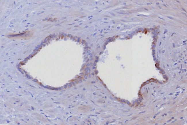 Cytokeratin 6/KRT6 (Pan; a,b,c) (Basal Cell Marker) Antibody in Immunohistochemistry (Paraffin) (IHC (P))