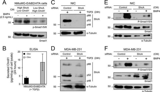 SMAD1 Antibody in Western Blot (WB)