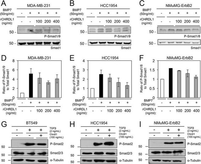 SMAD1 Antibody in Western Blot (WB)