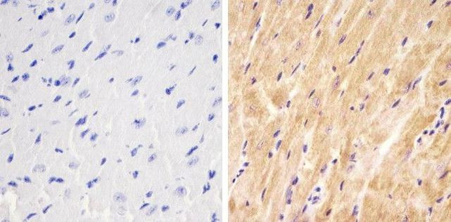 SMAD1 Antibody in Immunohistochemistry (Paraffin) (IHC (P))