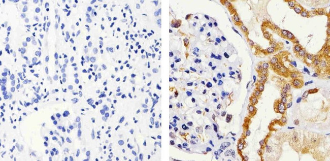 IRAK1 Antibody in Immunohistochemistry (Paraffin) (IHC (P))