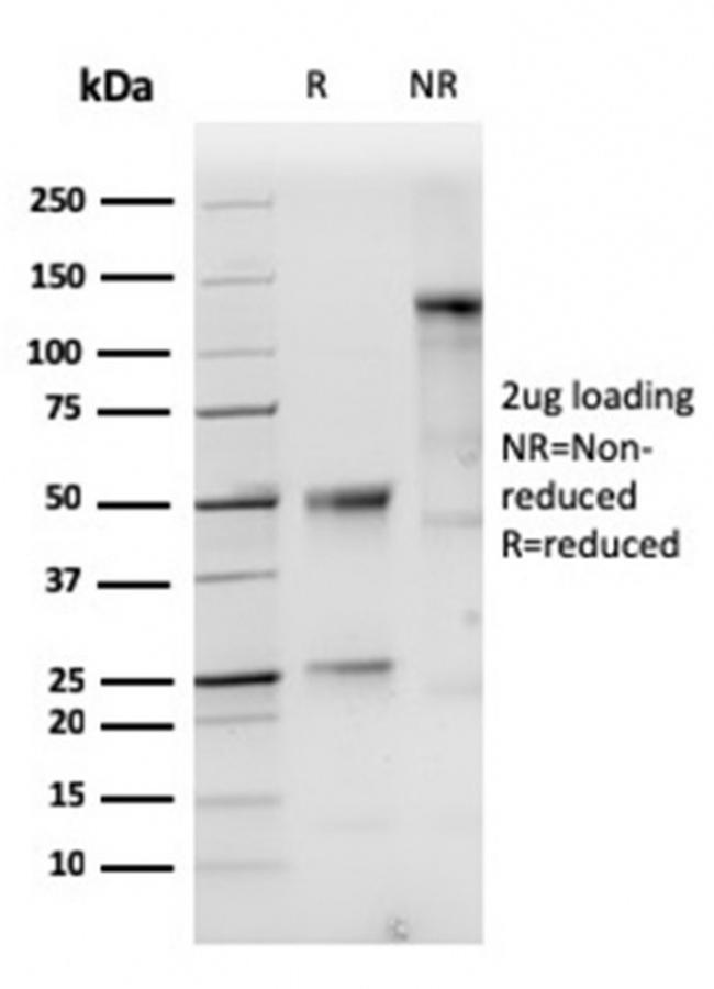 Cytokeratin 10 Antibody in SDS-PAGE (SDS-PAGE)