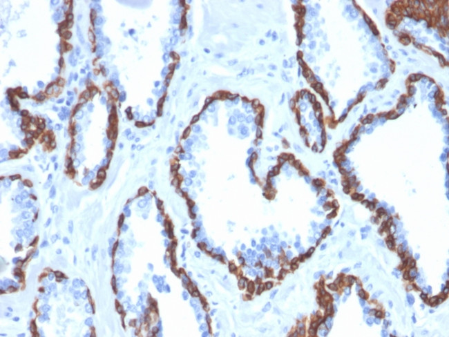 Cytokeratin 13 (Non-Keratinized Squamous Epithelial Marker) Antibody in Immunohistochemistry (Paraffin) (IHC (P))