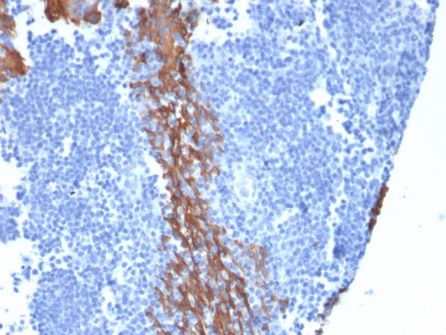 Cytokeratin 13 (Non-Keratinized Squamous Epithelial Marker) Antibody in Immunohistochemistry (Paraffin) (IHC (P))