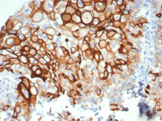 Cytokeratin 14 (KRT14) (Squamous Cell Marker) Antibody in Immunohistochemistry (Paraffin) (IHC (P))
