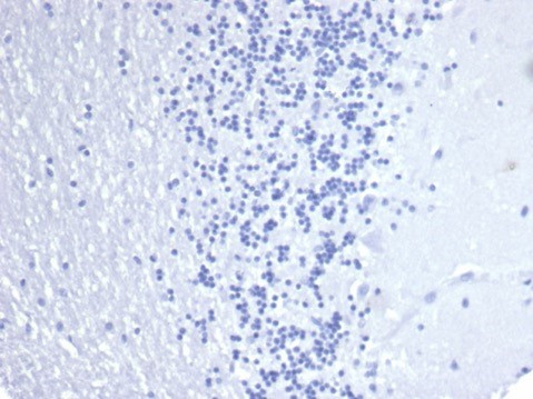 Cytokeratin 14 (KRT14) (Squamous Cell Marker) Antibody in Immunohistochemistry (Paraffin) (IHC (P))