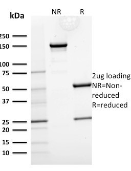 Cytokeratin 15 (Esophageal Squamous Cell Carcinoma Marker) Antibody in SDS-PAGE (SDS-PAGE)
