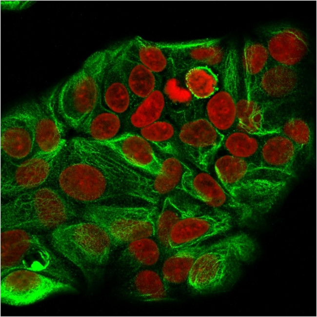 Cytokeratin 15 (Esophageal Squamous Cell Carcinoma Marker) Antibody in Immunocytochemistry (ICC/IF)