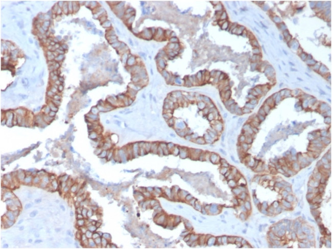 Cytokeratin 15 (Esophageal Squamous Cell Carcinoma Marker) Antibody in Immunohistochemistry (Paraffin) (IHC (P))