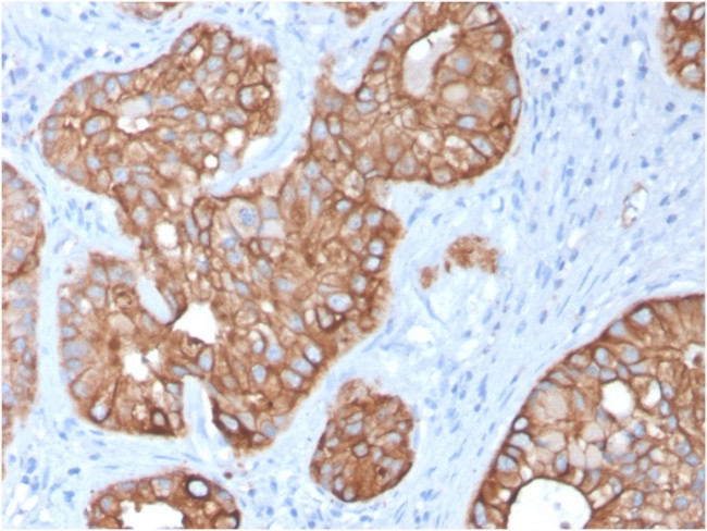 Cytokeratin 15 (Esophageal Squamous Cell Carcinoma Marker) Antibody in Immunohistochemistry (Paraffin) (IHC (P))