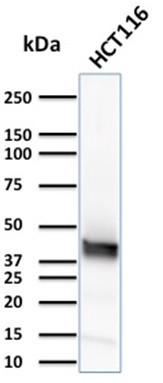 Cytokeratin 15 (Esophageal Squamous Cell Carcinoma Marker) Antibody in Western Blot (WB)