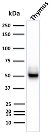 Cytokeratin 15 (Esophageal Squamous Cell Carcinoma Marker) Antibody in Western Blot (WB)