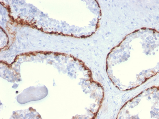 Cytokeratin 15 (Esophageal Squamous Cell Carcinoma Marker) Antibody in Immunohistochemistry (Paraffin) (IHC (P))