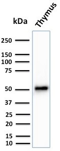 Cytokeratin 15 (Esophageal Squamous Cell Carcinoma Marker) Antibody in Western Blot (WB)