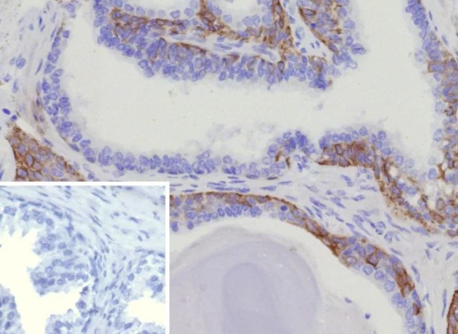 Cytokeratin 15 (Esophageal Squamous Cell Carcinoma Marker) Antibody in Immunohistochemistry (Paraffin) (IHC (P))