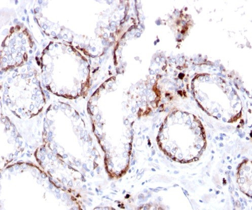 Cytokeratin 15 (Esophageal Squamous Cell Carcinoma Marker) Antibody in Immunohistochemistry (Paraffin) (IHC (P))