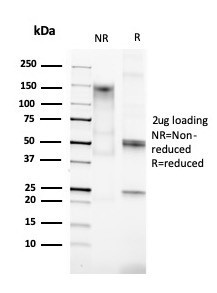 Cytokeratin 15 (Esophageal Squamous Cell Carcinoma Marker) Antibody in SDS-PAGE (SDS-PAGE)