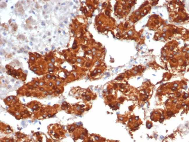 Interleukin-31/IL-33 Antibody in Immunohistochemistry (Paraffin) (IHC (P))