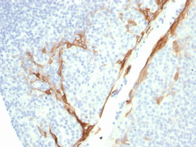 Cytokeratin 16 (KRT16) Antibody in Immunohistochemistry (Paraffin) (IHC (P))