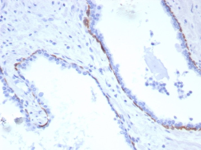 Cytokeratin 17 (CK17) (Basal Epithelial Marker) Antibody in Immunohistochemistry (Paraffin) (IHC (P))