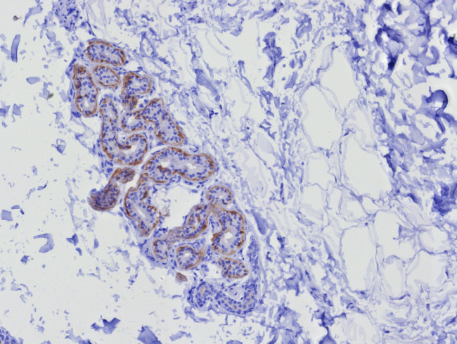 Cytokeratin 17 (CK17) (Basal Epithelial Marker) Antibody in Immunohistochemistry (Paraffin) (IHC (P))