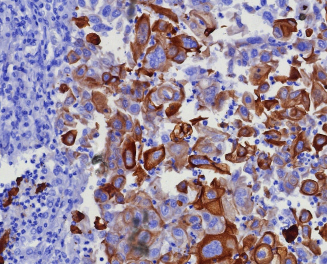 Cytokeratin 17 (CK17) (Basal Epithelial Marker) Antibody in Immunohistochemistry (Paraffin) (IHC (P))