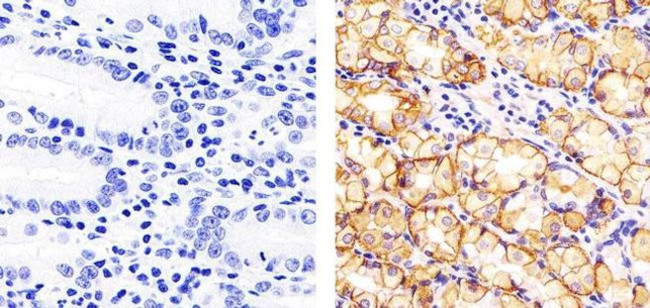 Claudin 18 Antibody in Immunohistochemistry (Paraffin) (IHC (P))