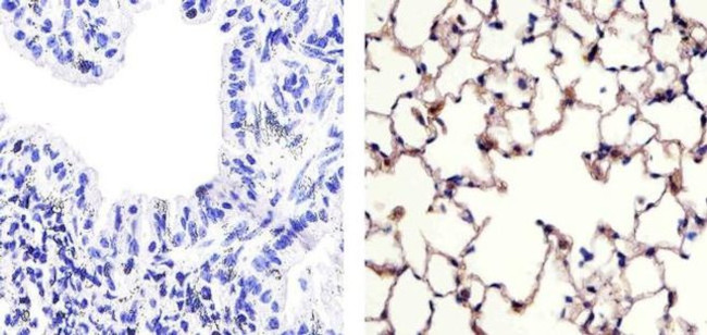 Claudin 18 Antibody in Immunohistochemistry (Paraffin) (IHC (P))