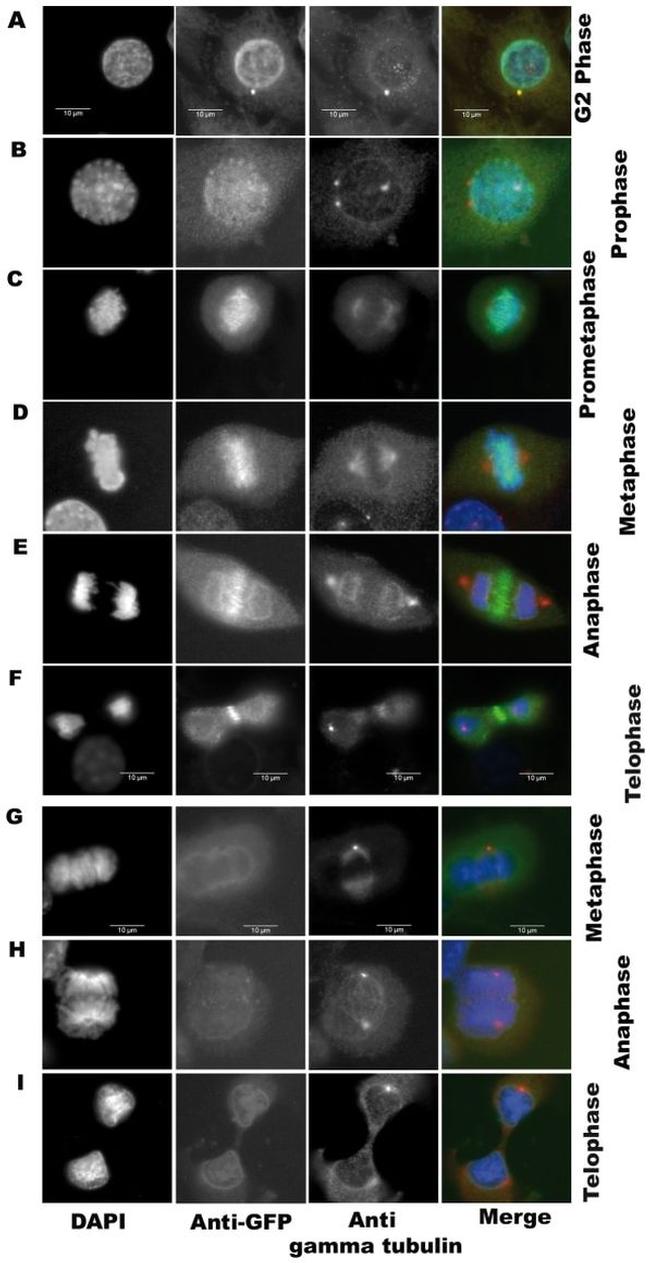 Aurora C Antibody in Immunocytochemistry (ICC/IF)