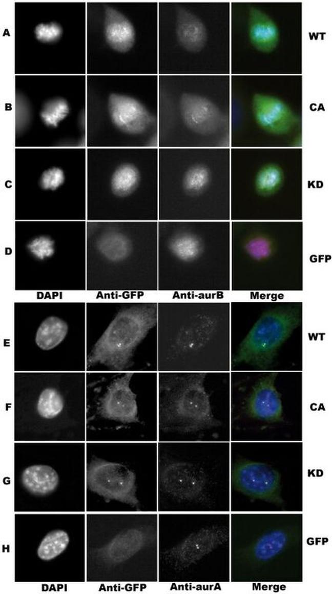 Aurora C Antibody in Immunocytochemistry (ICC/IF)