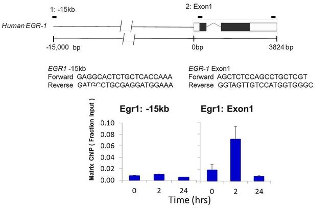 PIM1 Antibody