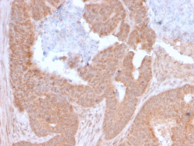 Lymphocyte Activation Gene 3 (LAG-3) (Negative Checkpoint Regulator) Antibody in Immunohistochemistry (Paraffin) (IHC (P))