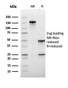 Lymphocyte Activation Gene 3 (LAG-3) (Negative Checkpoint Regulator) Antibody in SDS-PAGE (SDS-PAGE)