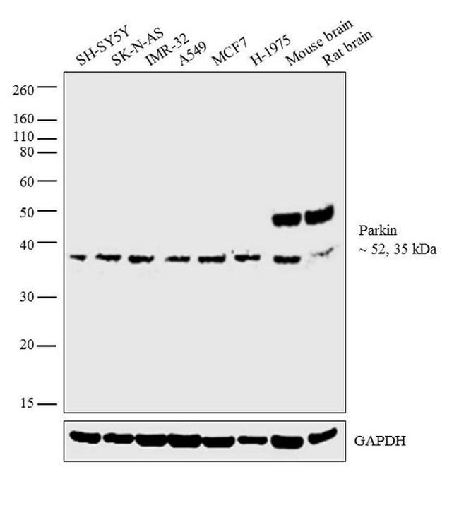 Parkin Antibody in Western Blot (WB)