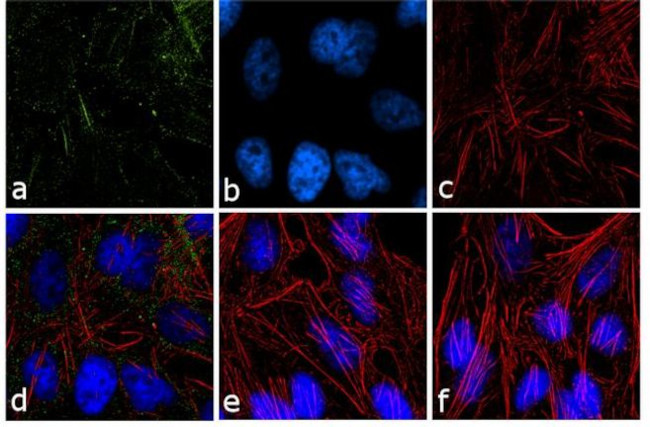 PPAP2B Antibody in Immunocytochemistry (ICC/IF)