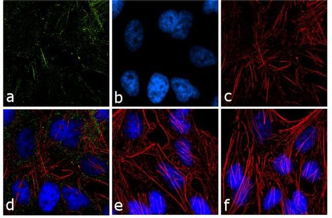 PPAP2B Antibody