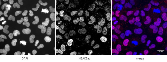 Histone H2AK5ac Antibody in Immunocytochemistry (ICC/IF)