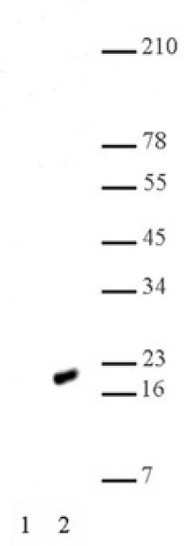 Histone H2AK5ac Antibody in Western Blot (WB)